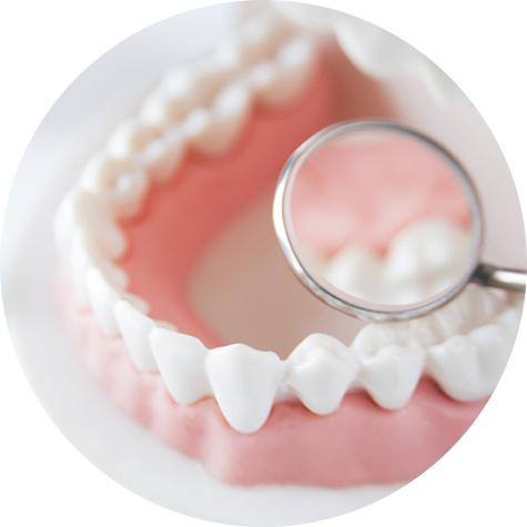 歯周病の管理